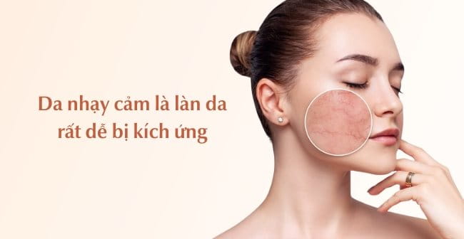 Cách nhận biết da thường và da nhạy cảm: Da nhạy cảm dễ bị kích ứng