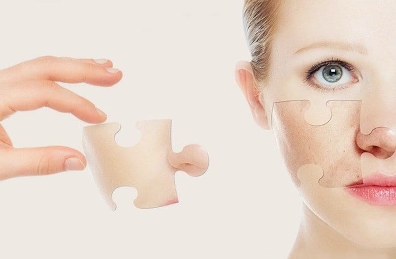 Peel da đúng cách có thể giúp khắc phục rất nhiều vấn đề về da khác nhau