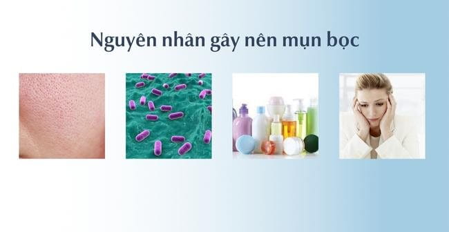 Nguyên nhân gây nên mụn bọc