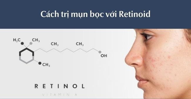 Trị mụn bọc với Retinoid