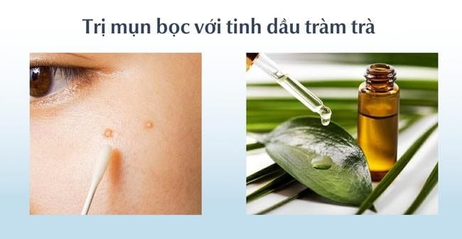 Tinh dầu tràm trà trị mụn bọc sưng đỏ