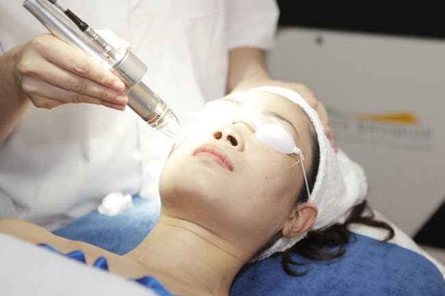 Liệu pháp laser YAG - phương pháp điều trị da có công dụng vượt trội và siêu hiệu quả 