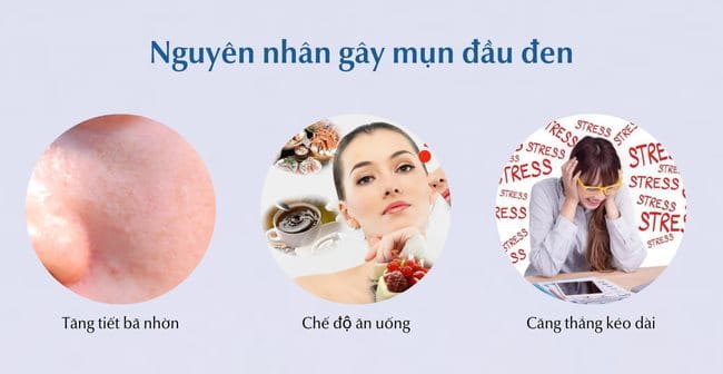 Nguyên nhân gây mụn đầu đen