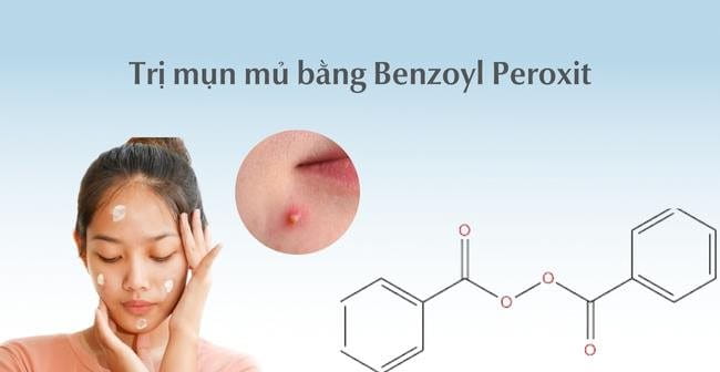 Dùng Benzoyl Peroxit để trị mụn mủ