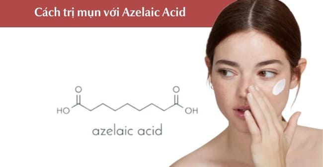 Azelaic Acid giúp trị mụn hiệu quả