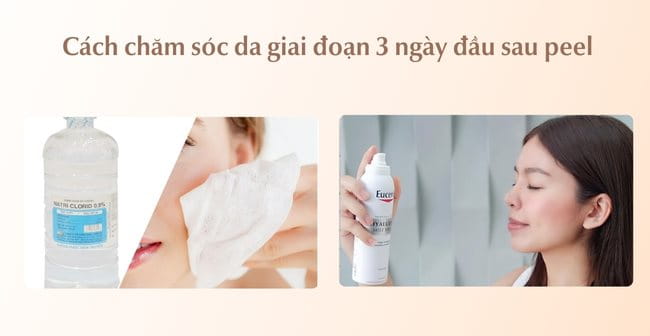 Cách chăm sóc da giai đoạn 3 ngày đầu sau peel