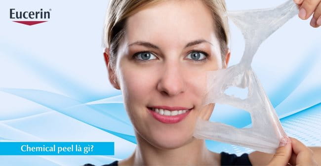 Chemical peel là gì?