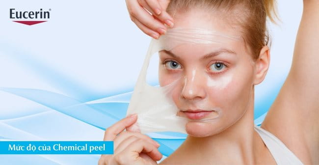 Phân loại chemical peel