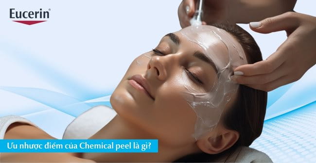 Ưu nhược điểm của Chemical peel là gì?