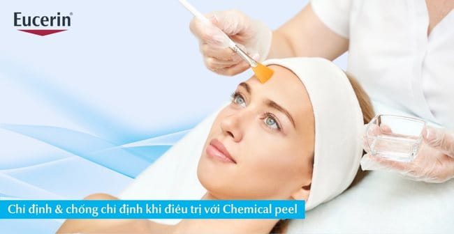 Chỉ định & chống chỉ định khi điều trị với Chemical peel là gì?