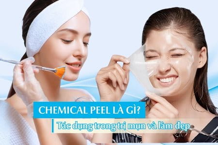 Chemical peel là gì? Chemical peel có tác dụng gì trong trị mụn và làm đẹp?