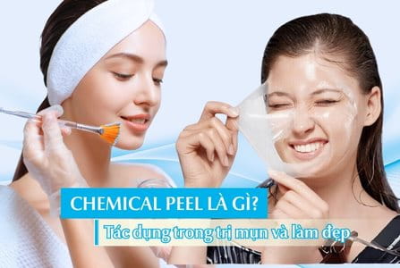 Chemical peel là gì? Chemical peel có tác dụng gì trong trị mụn và làm đẹp?