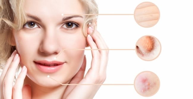 Collagen có tác dụng làm mờ nếp nhăn, ngăn ngừa lão hóa