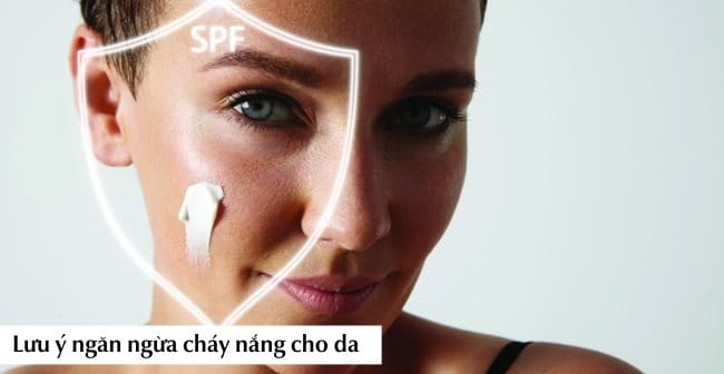 Lưu ý ngăn ngừa cháy nắng cho da