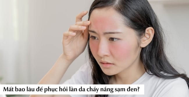 Da bị cháy nắng sạm đen bao lâu thì hết?