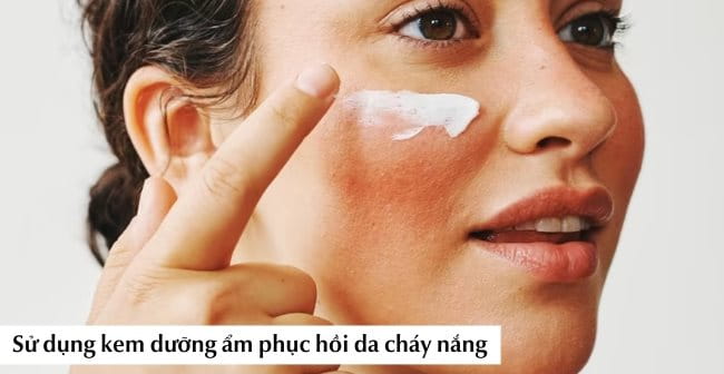 Sử dụng kem dưỡng ẩm phục hồi da cháy nắng