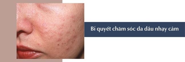 Cách chăm sóc da dầu nhạy cảm hiệu quả