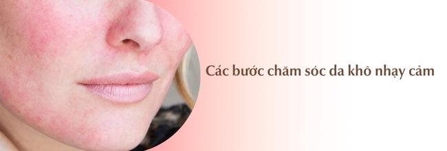 Các bước chăm sóc da khô nhạy cảm đơn giản, hiệu quả