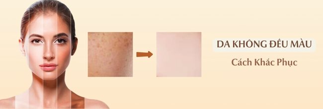 Da không đều màu