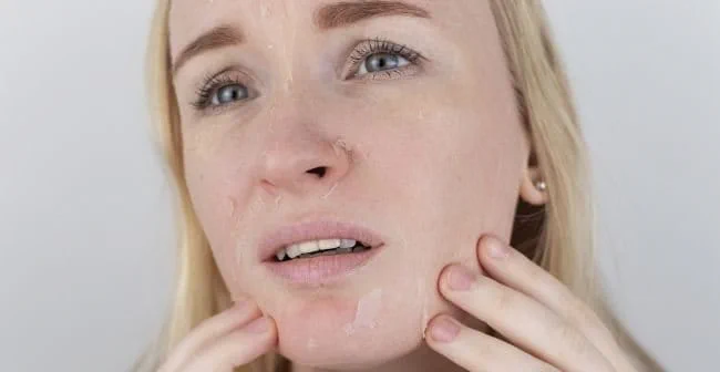 Các nhân tố bên trong khiến da khô sần sùi