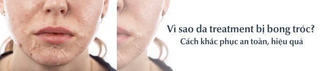 Da treatment bị bong tróc