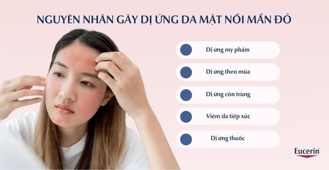 Nguyên nhân khiến da mặt dị ứng nổi mẩn đỏ ngứa