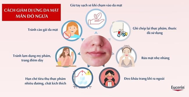 Cách giảm dị ứng da mặt mẩn đỏ ngứa tại nhà