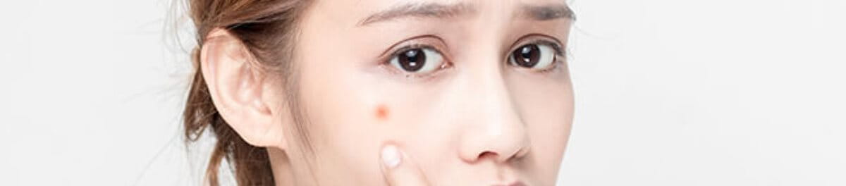 dược mỹ phẩm trị mụn