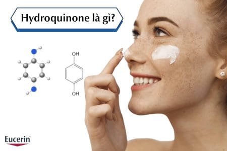 Hydroquinone là gì?
