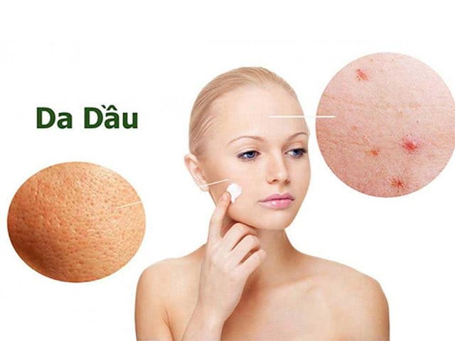 kem trị mụn cho da dầu