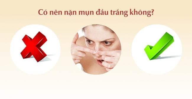 Có nên nặn mụn đầu trắng?