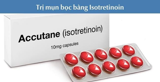 Mụn bọc bao lâu thì chín? Trị mụn bọc bằng Isotretinoin