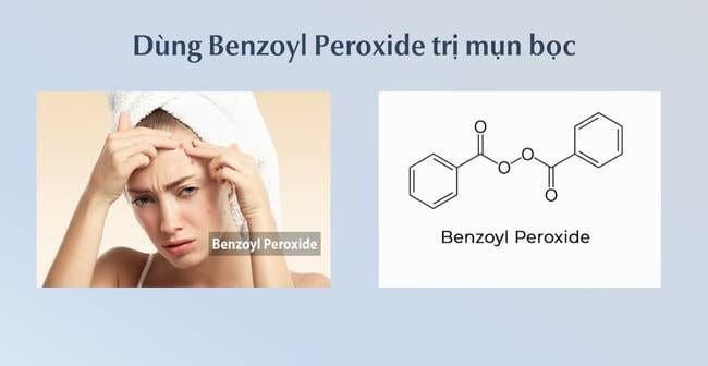 Mụn bọc bao lâu thì chín? Trị mụn bọc với Benzoyl Peroxide