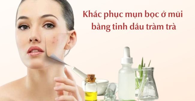 Khắc phục mụn bọc ở mũi với tinh dầu tràm trà