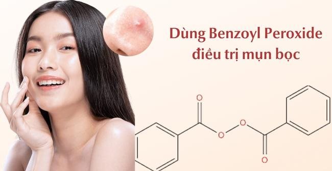 Trị mụn bọc ở mũi bằng Benzoyl Peroxide