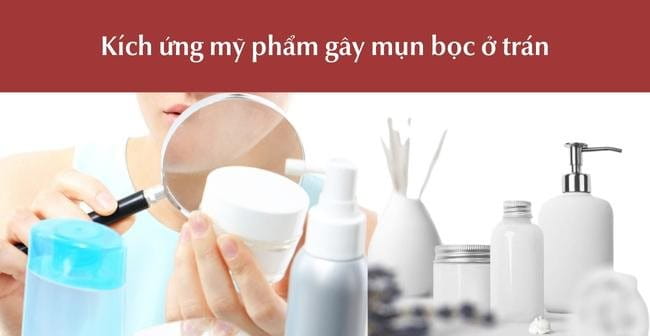 kích ứng mỹ phẩm gây mụn bọc ở trán