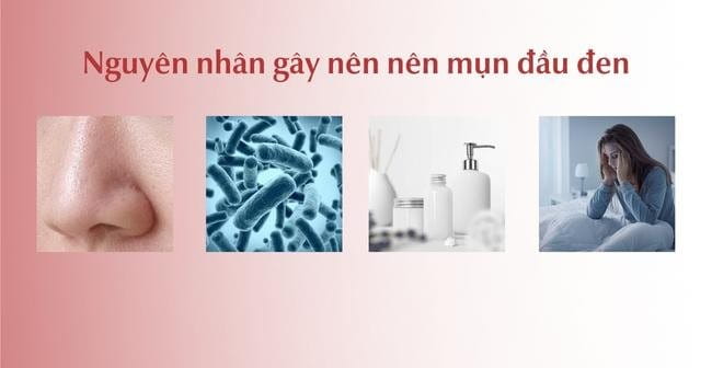 Nguyên nhân gây mụn đầu đen ở mũi