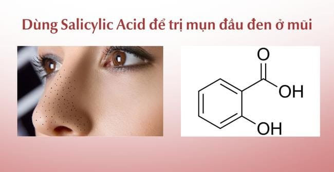Cách trị mụn đầu đen ở mũi bằng Salicylic Acid
