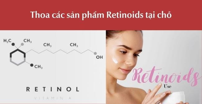 Trị mụn đầu đen bằng Retinoids