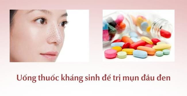 Uống thuốc kháng sinh trị mụn