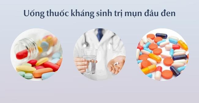 Uống thuốc kháng sinh trị mụn đầu đen