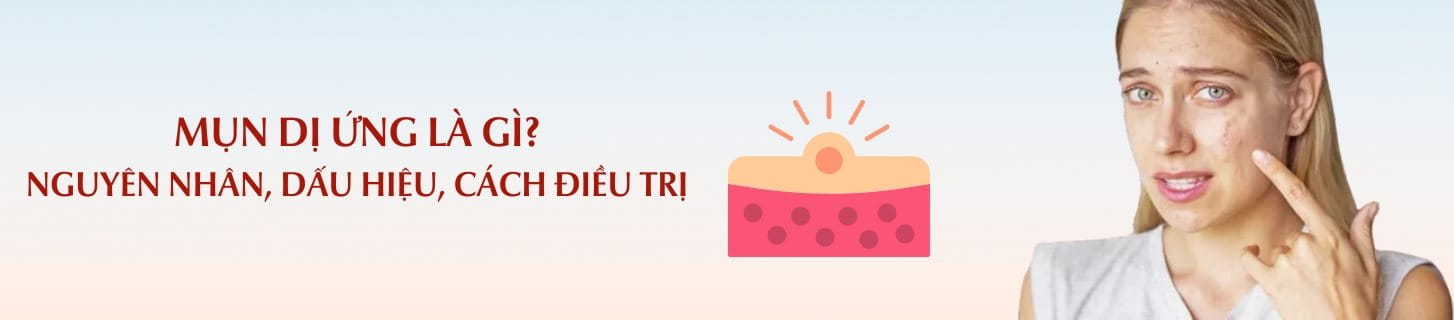 Mụn dị ứng