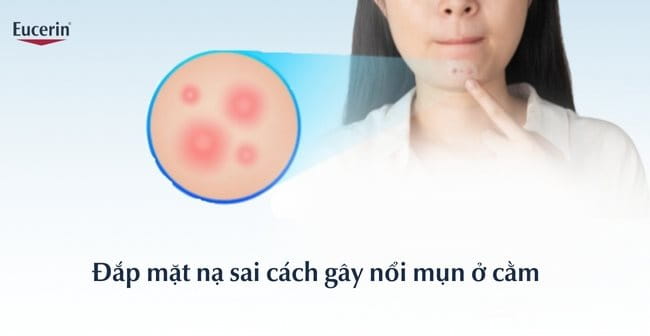 Đắp mặt nạ sai cách gây nổi mụn ở cằm