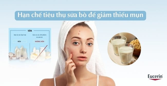 Hạn chế tiêu thụ sữa bò khi bị mụn