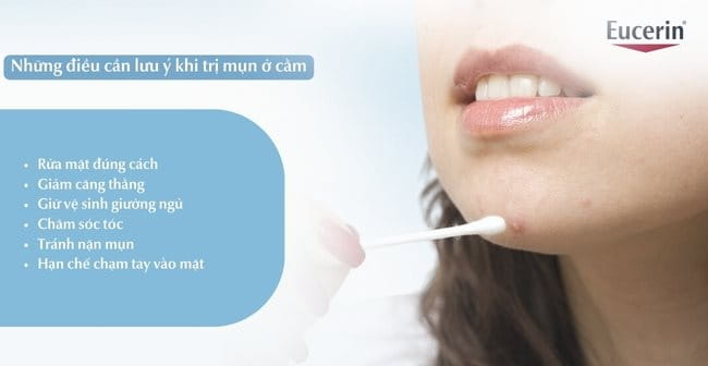 Những điều cần lưu ý khi trị mụn ở cằm