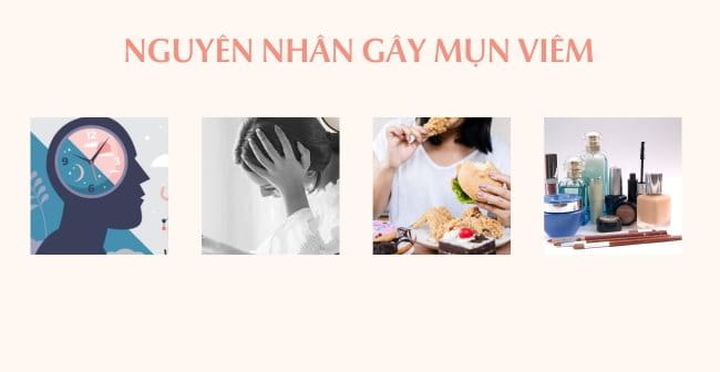 Nguyên nhân gây mụn viêm