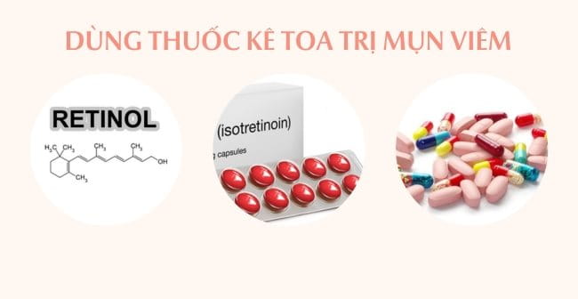 Sử dụng thuốc kê toa trị mụn viêm