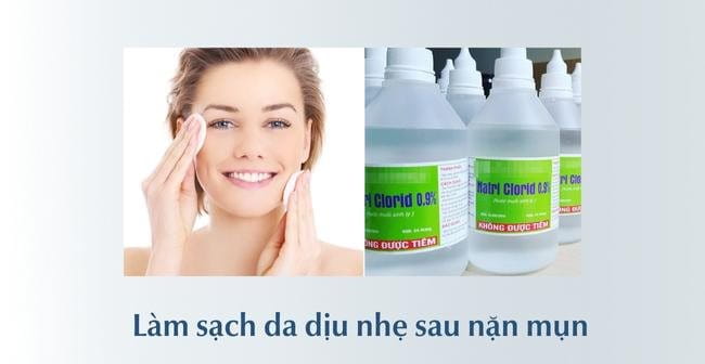 Làm sạch da sau nặn mụn