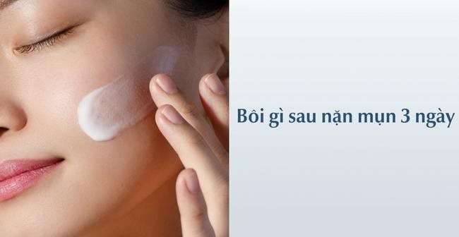 Nặn mụn xong nên bôi gì sau 3 ngày