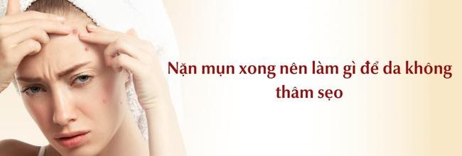 Chăm sóc da đúng cách sau nặn mụn